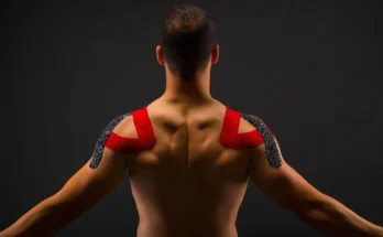 Kinesiology Tape for Shoulder Pain